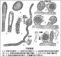 精子囊